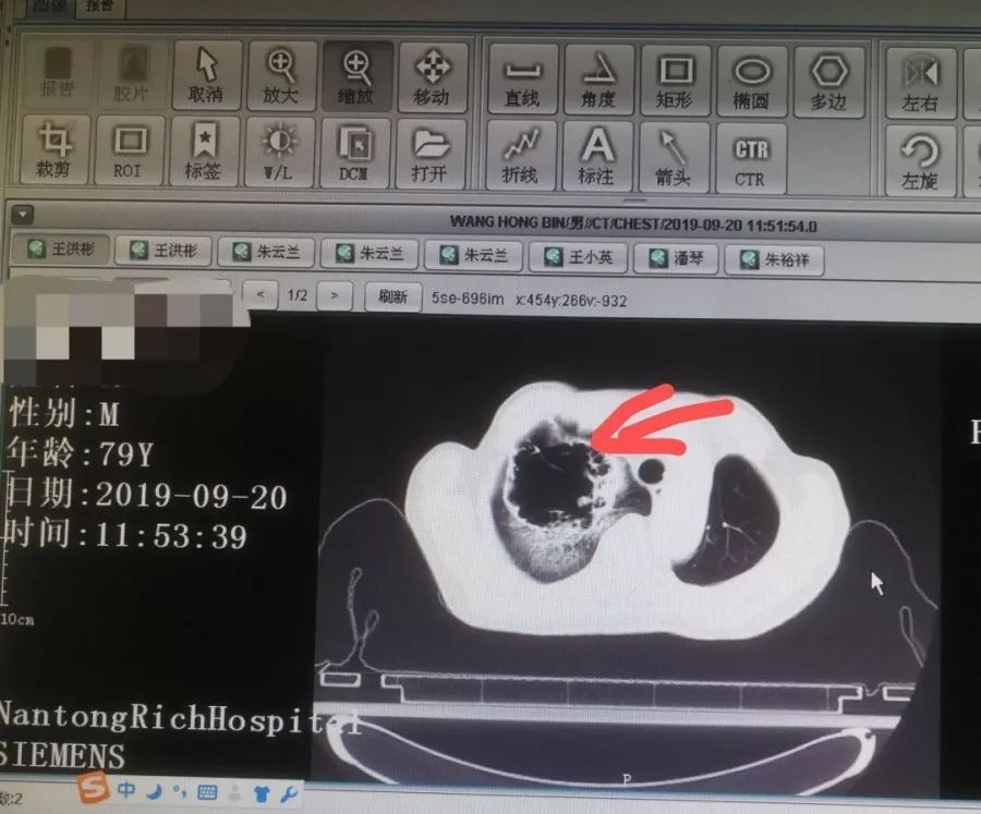 前.jpg